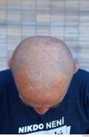  Street  809 bald head 0006.jpg